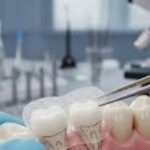 Imagem destacada – Adesivo inovador promete estimular crescimento natural dos dentes